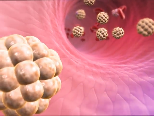 cholesteral2