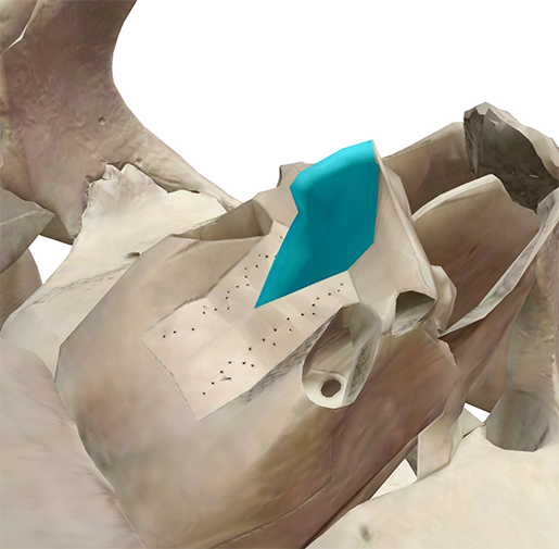 ethmoid4