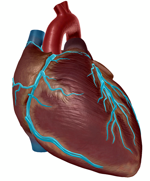 heartattack2