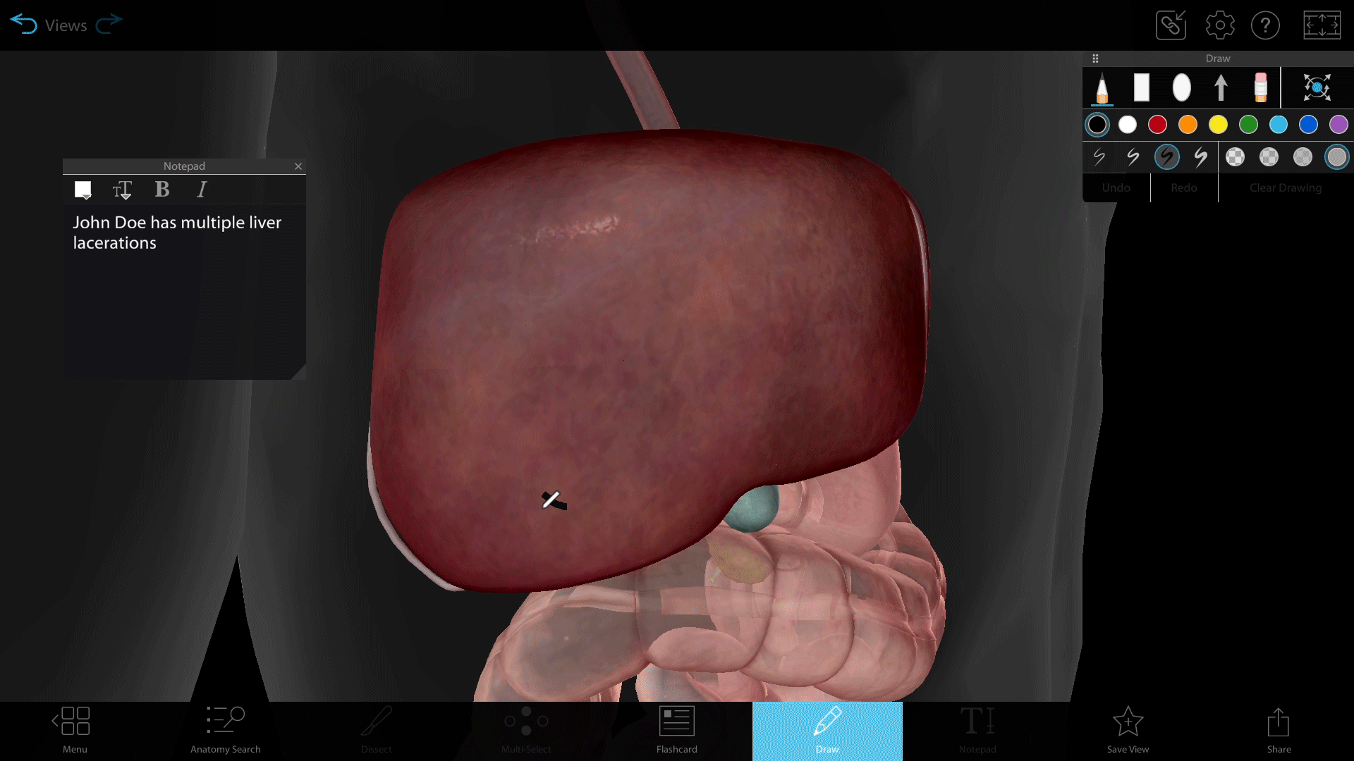 laceration-liver-draw-tool