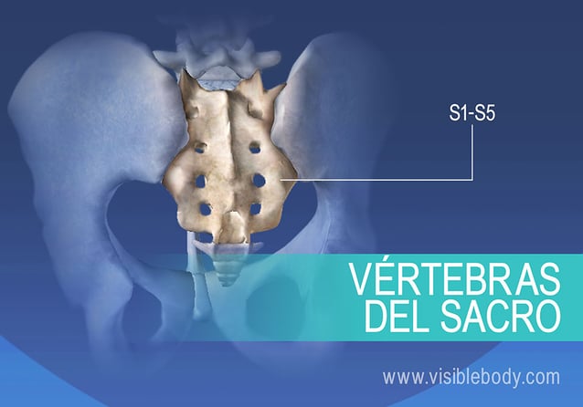 Vértebras sacras fusionadas, S1-S5