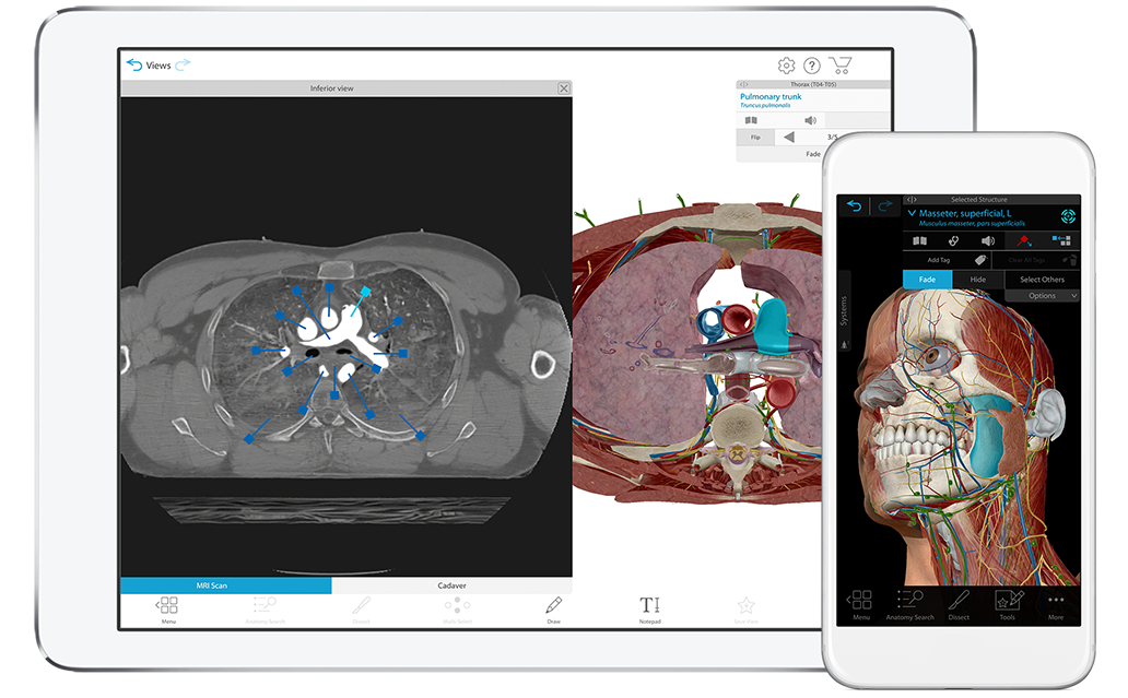 human anatomy atlas visual 3d gross