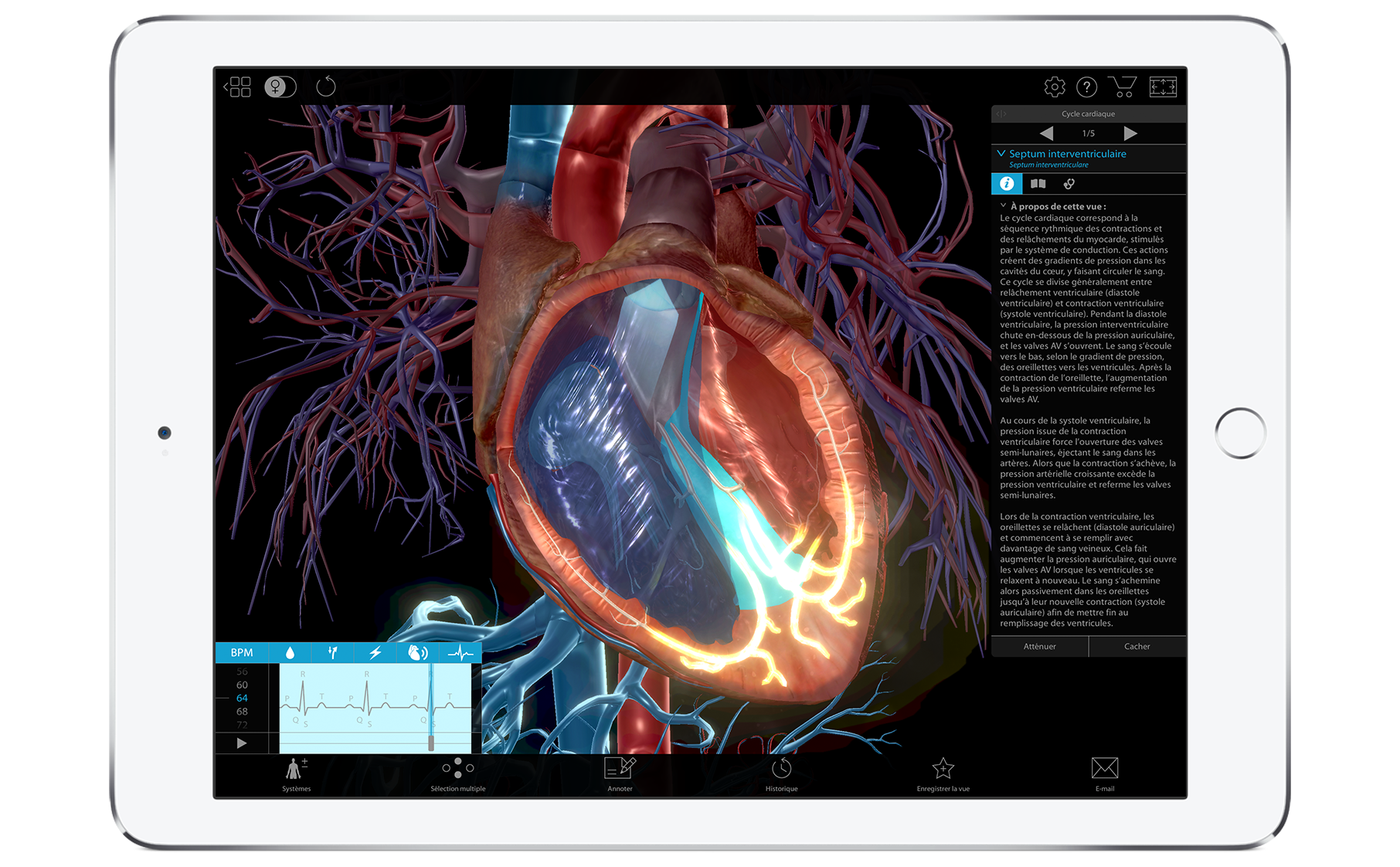 3d model of human heart from Pathology & Physiology