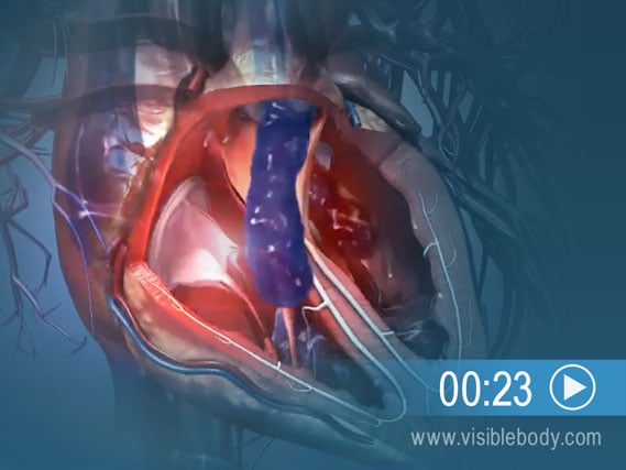 Cliquez ici pour visualiser une animation illustrant le pompage du cœur