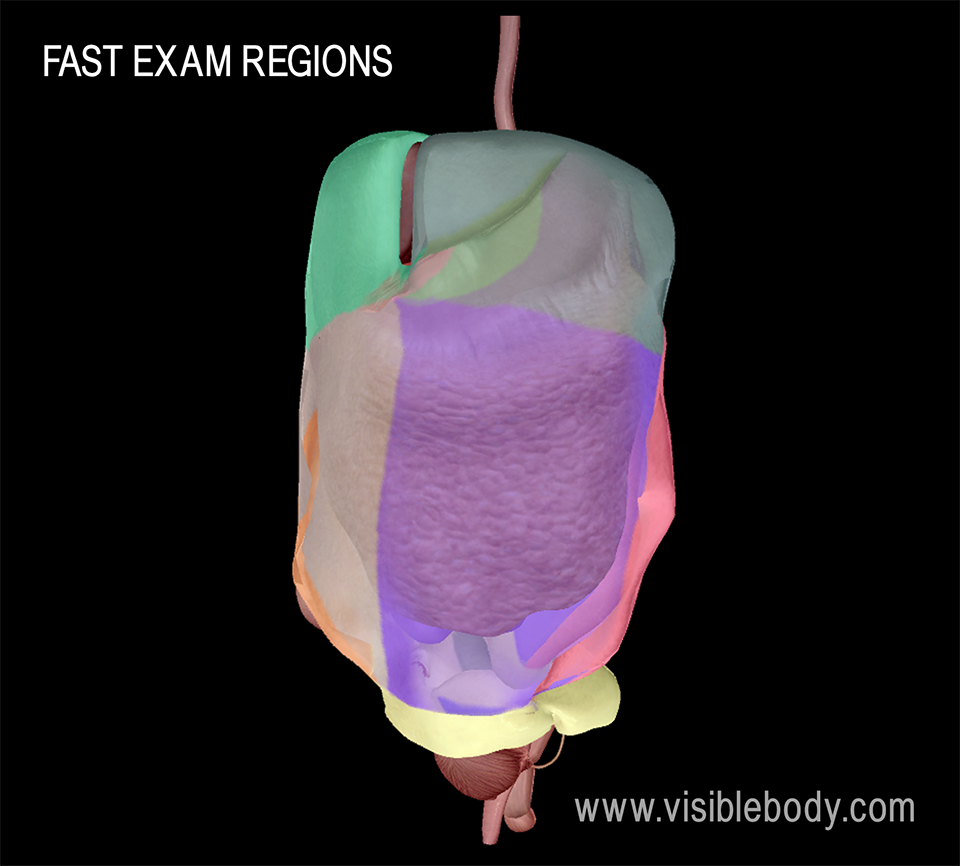 The FAST exam looks for fluid buildup in these regions of the abdomen. This image shows those regions on a female model.
