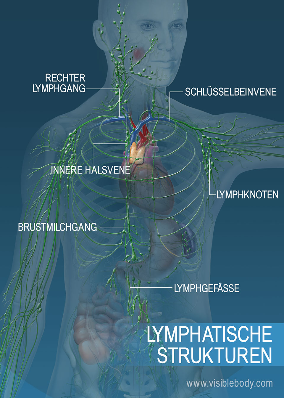 Das lymphatische Gefäßnetz im Rumpf- und Armbereich. Zu den Hauptstrukturen zählen: Brustmilchgang, rechter Lymphgang und Lymphgefäße.