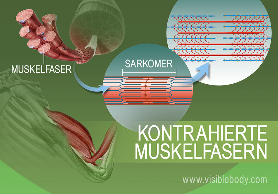 Kontrahierter Zustand der Sarkomere