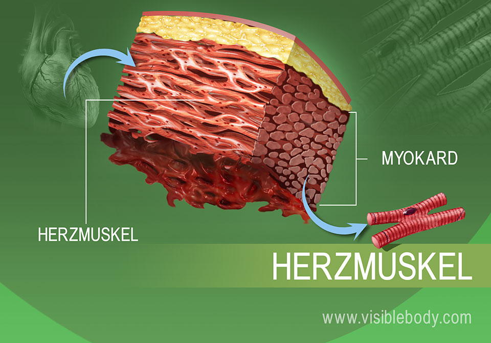 Vergrößerung des Herzmuskelgewebes im menschlichen Körper