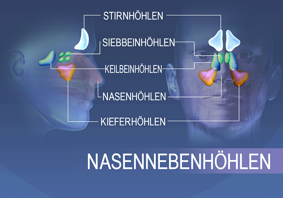 Lokalisation der Nasennebenhöhlen: Stirnbein, Siebbein, Keilbein und Oberkiefer