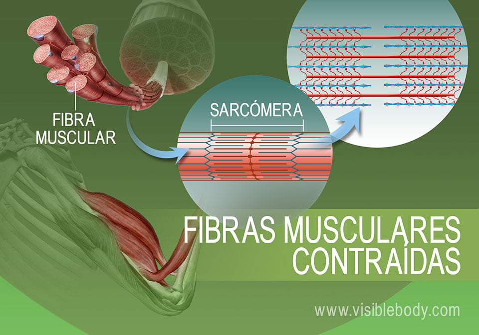 Estado de contracción de las sarcómeras