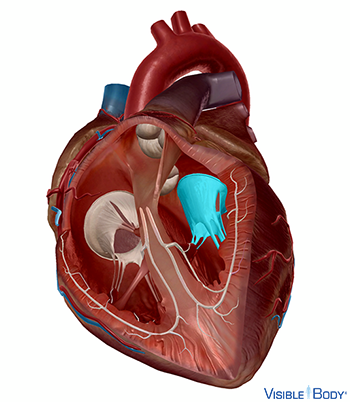 Mitralklappe (zweizipflig)