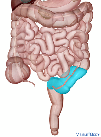 El colon sigmoide resaltado en el contexto del intestino grueso