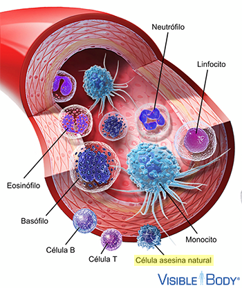Célula asesina natural