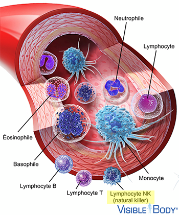 Lymphocyte NK (natural killer)