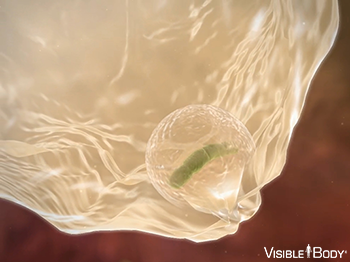 Ein Phagozyt, der einen Mikroorganismus aufnimmt