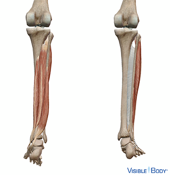 Deux jambes avec les muscles contrôlant les chevilles : un pied incliné vers l'intérieur, l'autre vers l'extérieur
