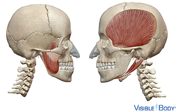 Deux crânes avec les muscles contrôlant la mâchoire : l'un avec la mâchoire avancée vers l'avant, l'autre au repos