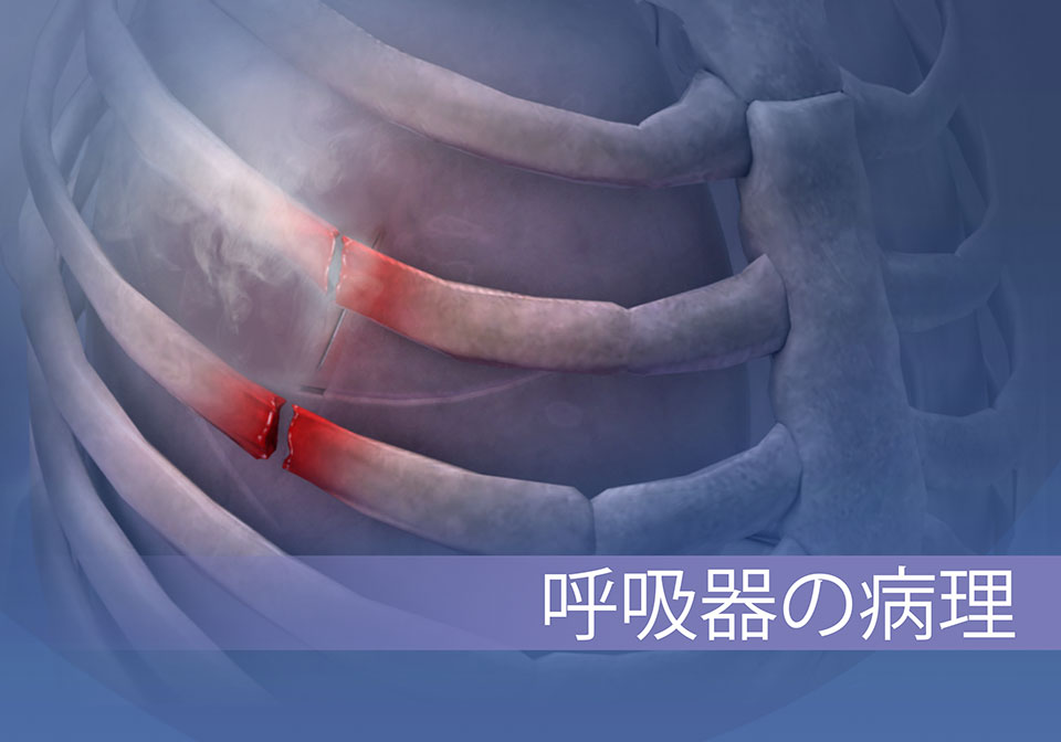 一般的な呼吸器系の障害は、肺の虚脱（図示）、 気管支炎、喘息、およびその他などが挙げられます