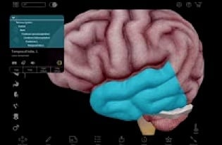 3D rendering of a human brain with temporal lobe highlighted