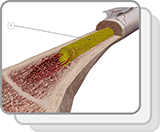 Sectioned Femur