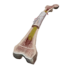 Sectioned Femur